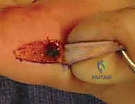 العلاج الطبيعي والتأهيل