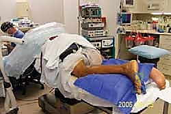 صورة توضيحية لـ إصلاح وتر أخيل المفتوح بتقنية "صندوق الهدايا": دليل شامل من الأستاذ الدكتور محمد هطيف