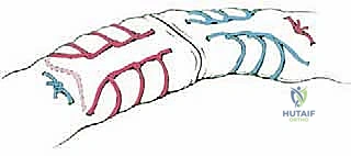 صورة طبية: إصلاح وتر أخيل المفتوح بتقنية "صندوق الهدايا": دليل شامل من الأستاذ الدكتور محمد هطيف