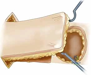التشريح المعقد لليد والأطراف العلوية