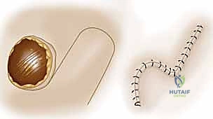 رفع السديلة مع الحفاظ على التروية الدموية