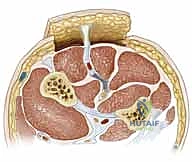 صورة طبية: ترميم الأطراف العلوية المتقدم: تقنيات السدائل الجراحية لإعادة الوظيفة والجمال مع الأستاذ الدكتور محمد هطيف