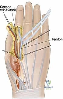 صورة طبية: ترميم الأطراف العلوية المتقدم: تقنيات السدائل الجراحية لإعادة الوظيفة والجمال مع الأستاذ الدكتور محمد هطيف