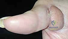 تجهيز المنطقة المستقبلة للسديلة