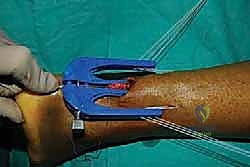 تجهيز المريض ووضعية الانبطاح