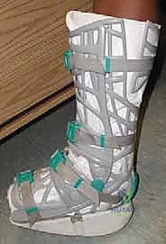 Intraoperative Surgical Step