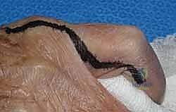 Clinical Image