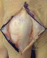 Clinical Image