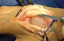 Clinical Image