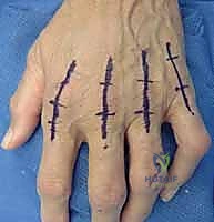 Arab Ortho Board MCQs - Part 36