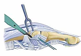 Clinical Image