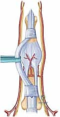 Clinical Image