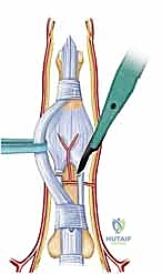 Clinical Image