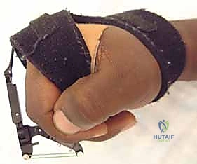 Clinical Image