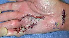 أحدث التقنيات الجراحية في عيادة الدكتور محمد هطيف بصنعاء