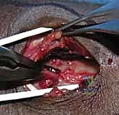 Clinical Image