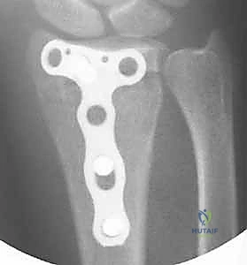 Clinical Image
