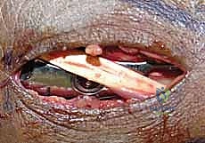 Clinical Image