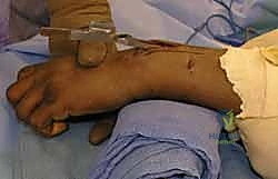Clinical Image