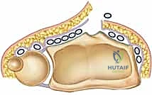 Clinical Image