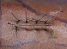 Clinical Image
