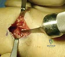 Clinical Image