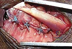 Clinical Image