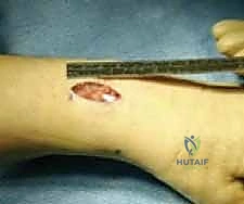 Clinical Image