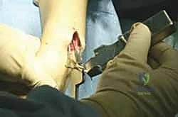 Clinical Image