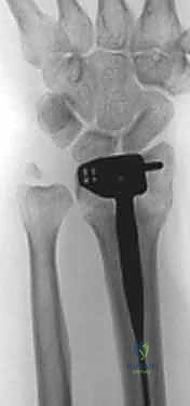 Clinical Image
