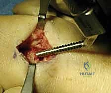 Clinical Image