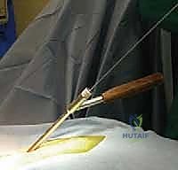 تركيب القضبان المعدنية