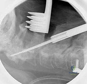 أدوات التثبيت الجراحي