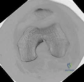 استخدام جهاز الأشعة C-Arm