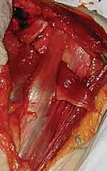 الخياطة والإغلاق التجميلي