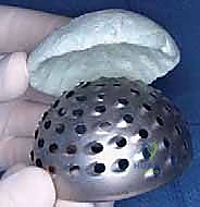 التشخيص الدقيق بالأشعة والموجات الصوتية لمفصل الورك