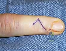 Clinical Image