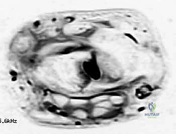 Clinical Image
