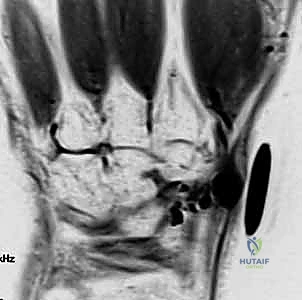 Clinical Image
