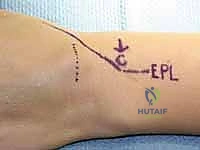 Clinical Image