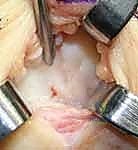 Clinical Image