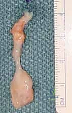 Clinical Image