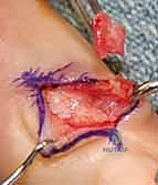 Clinical Image
