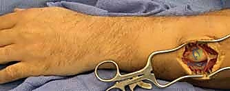 Pediatric orthopedic cases 30
