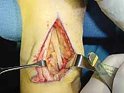 تجهيز المريض وتحديد مناطق التدخل الجراحي