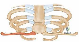 التخطيط الجراحي الدقيق قبل العملية