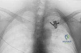 حفر الأنفاق العظمية بدقة فائقة