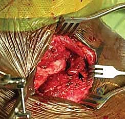 تقييم الأعراض والتشوه البصري