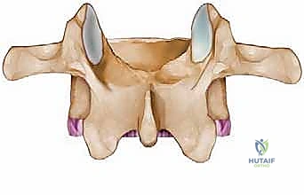 مراحل تطور الانزلاق الغضروفي القطني