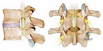 وصف طبي دقيق للمريض يبين الهياكل العصبية